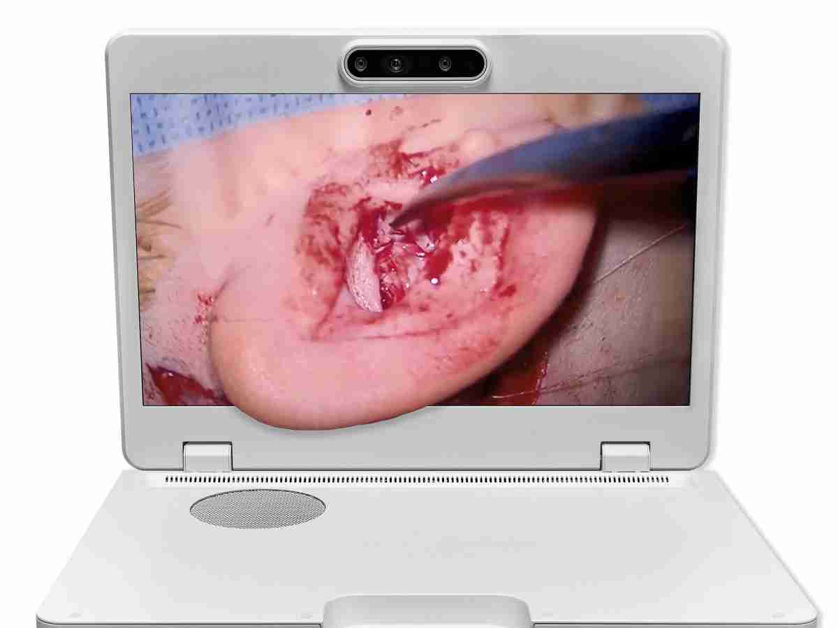 达擎之＂Heads-up 3D显微手术显示系统＂，，，整合4K裸眼3D显示及眼球追踪系统，，具备快速追踪人眼移动位置功能，，，减轻医师长时间维持固定姿势的负担，，让医师能有更宽广清晰的3D立体视野及更舒适的姿势来执行手术。。。